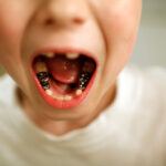 At what age do children's milk teeth fall?