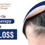 Guide-On-Mesotherapy-For-Hair-Loss-vjs-clinic