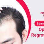 Option-For-Regrowth-Of-Hair!-profile