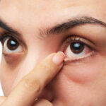 6 Tips to Keep your Eyes Healthy with Diabetes